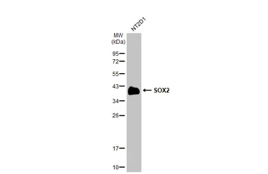Anti-SOX2 antibody [HL1193] used in Western Blot (WB). GTX636505