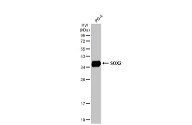 Anti-SOX2 antibody [HL1193] used in Western Blot (WB). GTX636505