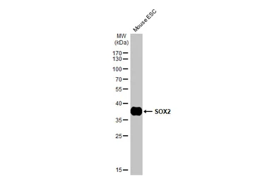 Anti-SOX2 antibody [HL1193] used in Western Blot (WB). GTX636505