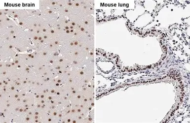 Anti-SOX2 antibody [HL1193] used in IHC (Paraffin sections) (IHC-P). GTX636505