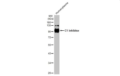 Anti-C1 inhibitor antibody [HL1197] used in Western Blot (WB). GTX636509