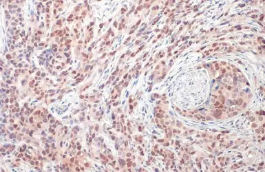 Anti-DUT antibody [HL1210] used in IHC (Paraffin sections) (IHC-P). GTX636527