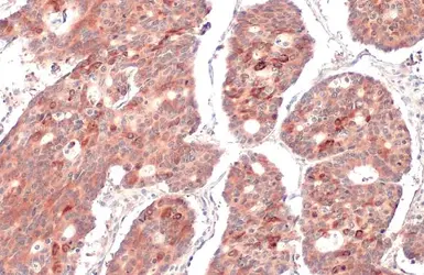 Anti-RRM1 antibody [HL1230] used in IHC (Paraffin sections) (IHC-P). GTX636578