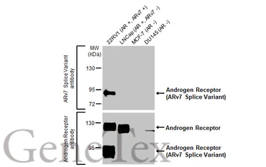 Anti-Androgen Receptor (ARv7 Splice Variant) antibody [HL1239] used in Western Blot (WB). GTX636638