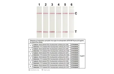 Anti-Respiratory Syncytial virus Nucleoprotein antibody [HL1248] used in Lateral Flow (Lateral Flow). GTX636650