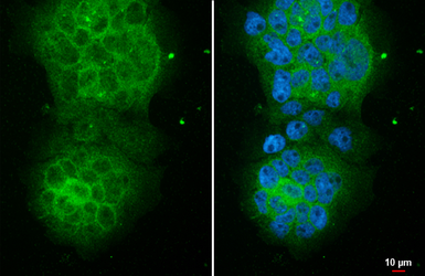 Anti-CYLD antibody [HL1260] used in Immunocytochemistry/ Immunofluorescence (ICC/IF). GTX636662