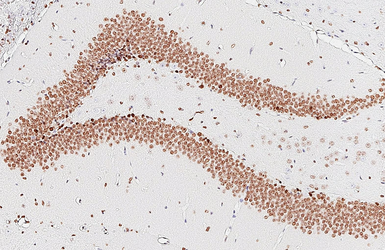 Anti-NFIX antibody [HL1269] used in IHC (Paraffin sections) (IHC-P). GTX636671