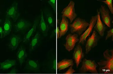 Anti-BRD9 antibody [HL1282] used in Immunocytochemistry/ Immunofluorescence (ICC/IF). GTX636696