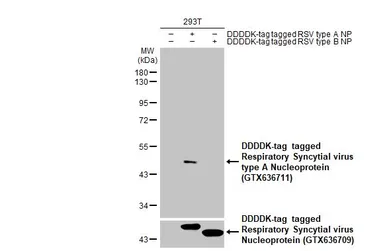 Anti-Respiratory Syncytial virus type A Nucleoprotein antibody [HL1297] used in Western Blot (WB). GTX636711