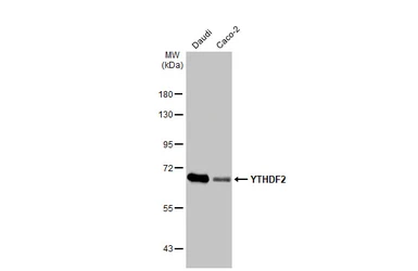 Anti-YTHDF2 antibody [HL1354] used in Western Blot (WB). GTX636774