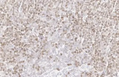 Anti-PARP antibody [HL1364] used in IHC (Paraffin sections) (IHC-P). GTX636804