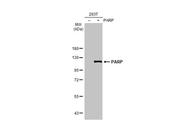 Anti-PARP antibody [HL1364] used in Western Blot (WB). GTX636804