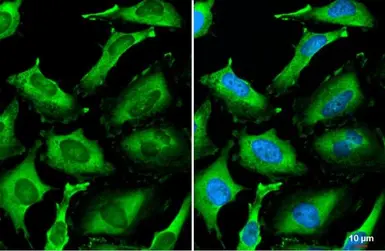 Anti-PI3 kinase p85 alpha antibody [HL1398] used in Immunocytochemistry/ Immunofluorescence (ICC/IF). GTX636838