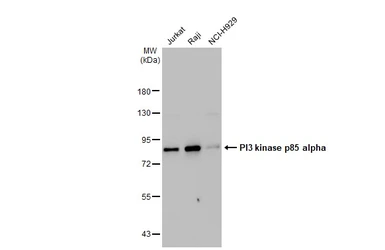 Anti-PI3 kinase p85 alpha antibody [HL1398] used in Western Blot (WB). GTX636838