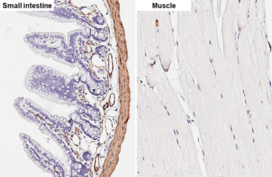 Anti-alpha Smooth Muscle Actin antibody [HL1419] used in IHC (Paraffin sections) (IHC-P). GTX636885
