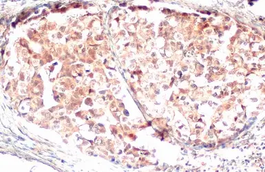 Anti-Gasdermin D antibody [HL1430] used in IHC (Paraffin sections) (IHC-P). GTX636896