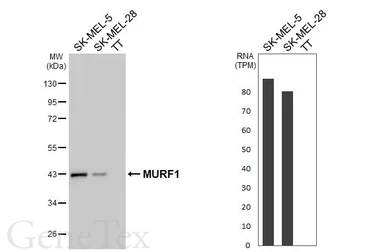 Anti-MURF1 antibody [HL1450] used in Western Blot (WB). GTX636922
