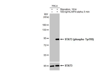 Anti-STAT3 (phospho Tyr705) antibody [HL1464] used in Western Blot (WB). GTX636938