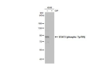Anti-STAT3 (phospho Tyr705) antibody [HL1464] used in Western Blot (WB). GTX636938