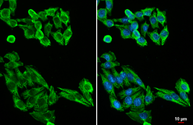 Anti-MC1 Receptor antibody [HL1470] used in Immunocytochemistry/ Immunofluorescence (ICC/IF). GTX636944