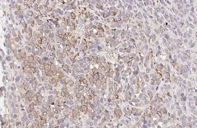 Anti-MC1 Receptor antibody [HL1471] used in IHC (Paraffin sections) (IHC-P). GTX636945