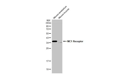 Anti-MC1 Receptor antibody [HL1471] used in Western Blot (WB). GTX636945