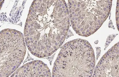 Anti-MC1 Receptor antibody [HL1471] used in IHC (Paraffin sections) (IHC-P). GTX636945