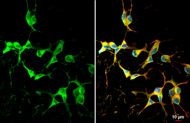 Anti-Dopamine Receptor D2 antibody [HL1478] used in Immunocytochemistry/ Immunofluorescence (ICC/IF). GTX636952