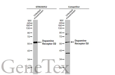 Anti-Dopamine Receptor D2 antibody [HL1478] used in Western Blot (WB). GTX636952
