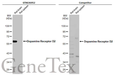 Anti-Dopamine Receptor D2 antibody [HL1478] used in Western Blot (WB). GTX636952