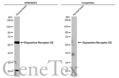 Anti-Dopamine Receptor D2 antibody [HL1478] used in Western Blot (WB). GTX636952