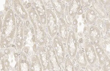 Anti-RAB5A antibody [HL1497] used in IHC (Paraffin sections) (IHC-P). GTX636971