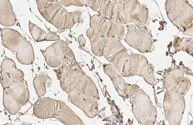 Anti-RAB5A antibody [HL1497] used in IHC (Paraffin sections) (IHC-P). GTX636971
