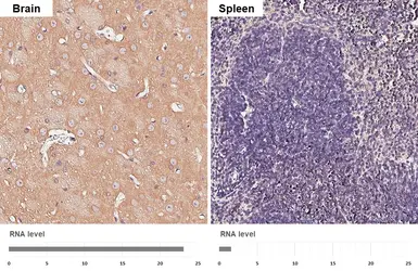 Anti-RAB5A antibody [HL1497] used in IHC (Paraffin sections) (IHC-P). GTX636971