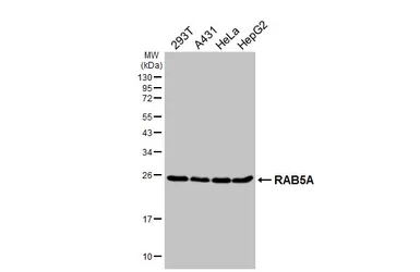 Anti-RAB5A antibody [HL1497] used in Western Blot (WB). GTX636971
