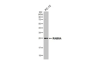 Anti-RAB5A antibody [HL1497] used in Western Blot (WB). GTX636971