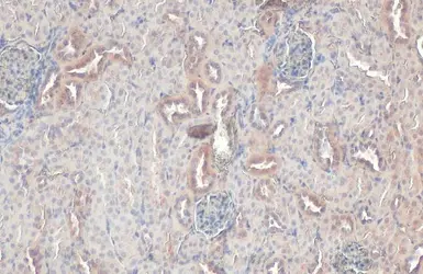 Anti-RAB5A antibody [HL1497] used in IHC (Paraffin sections) (IHC-P). GTX636971
