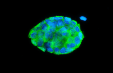 Anti-FABP4 antibody [HL1521] used in Immunocytochemistry/ Immunofluorescence (ICC/IF). GTX636995