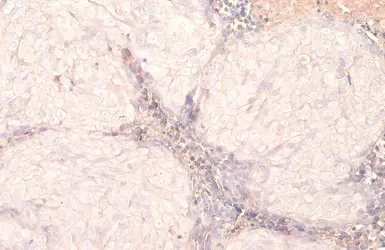 Anti-EpCAM antibody [HL1524] used in IHC (Paraffin sections) (IHC-P). GTX636998