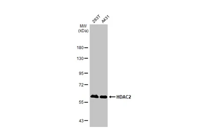 Anti-HDAC2 antibody [HL1545] used in Western Blot (WB). GTX637020