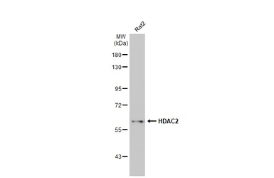 Anti-HDAC2 antibody [HL1545] used in Western Blot (WB). GTX637020