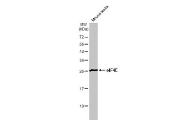 Anti-eIF4E antibody [HL1554] used in Western Blot (WB). GTX637029