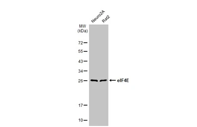 Anti-eIF4E antibody [HL1555] used in Western Blot (WB). GTX637030