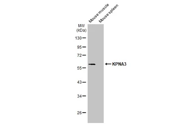Anti-KPNA3 antibody [HL1573] used in Western Blot (WB). GTX637048