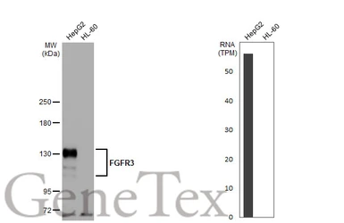 Anti-FGFR3 antibody [HL1595] used in Western Blot (WB). GTX637074