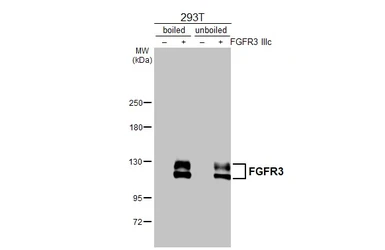 Anti-FGFR3 antibody [HL1595] used in Western Blot (WB). GTX637074