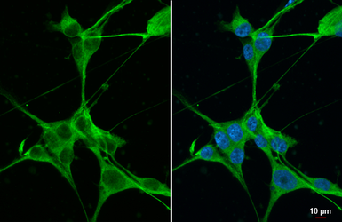 Anti-B-Raf antibody [HL1606] used in Immunocytochemistry/ Immunofluorescence (ICC/IF). GTX637085
