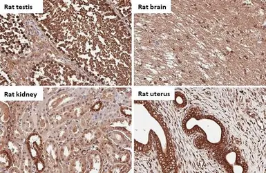 Anti-B-Raf antibody [HL1606] used in IHC (Paraffin sections) (IHC-P). GTX637085