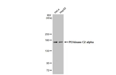 Anti-PI3 kinase C2 alpha antibody [HL1612] used in Western Blot (WB). GTX637103