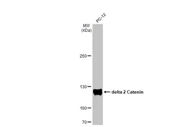 Anti-delta 2 Catenin antibody  [HL1629] used in Western Blot (WB). GTX637122